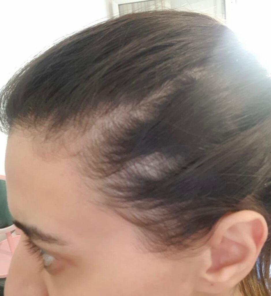 Image #1 from Rita